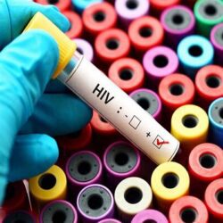 آزمایش روی حیوانات؛
                
                استفاد از نانومواد برای ساخت واکسن ایدز