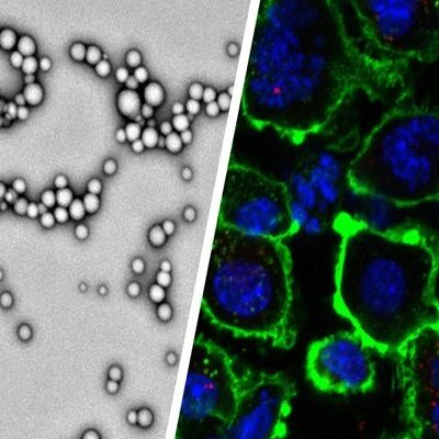 یافته جدید محققان؛
                
                طراحی نانوذراتی برای از بین بردن تومورهای بدخیم